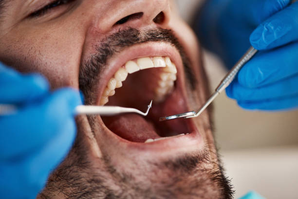 Best Emergency Dentist for Knocked-Out Tooth in Wakefield, KS